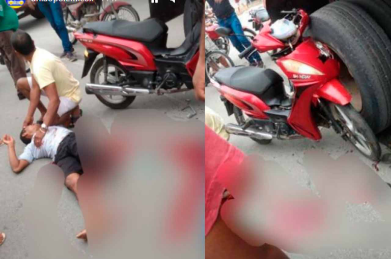 Motociclista sofre fratura exposta na perna após colisão com caminhão em Murici